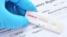 S-a aprobat un nou test pentru identificarea noului coronavirus, test despre care se spune că 