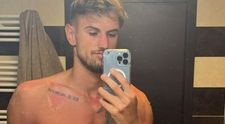 Ce a pățit Alex Delea după ce s-a întors de la Survivor România 2023