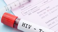 A doua persoană vindecată de HIV din lume și-a dezvăluit identitatea și își spune povestea