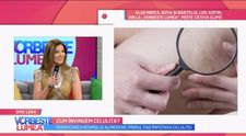 VIDEO Cum învingem celulita. Oana Cuzino ne oferă toate detaliile despre acest subiect