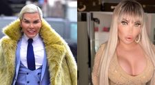 Jessica Alves, mutilată de intervențiile estetice. Imaginea care i-a șocat pe internauți