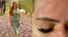 O celebră influenceriță, desfigurată după ce o oală sub presiune i-a explodat în față! Tânăra a fost la un pas de moarte: „Am apucat mânerul și...”