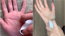 Deodorantul spray pe piele, o nouă provocare periculoasă pe TikTok! Tinerii se aleg cu arsuri grave și cicatrici pe viață