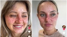 O nouă modă face “ravagii” printre puștoaice: tatuajul cu… pistrui. Cum arată chipul lor după tatuare