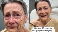 La 70 de ani și-a făcut un lifting facial, iar internauții au fost șocați de rezultat și l-au numit pe chirurgul plastician „omul-miracol”. Cum arată pensionara după procedura de întinerire