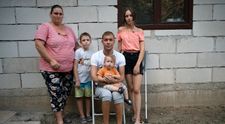 Povestea dură a unui om care suferă de o boală cumplită: ‘Am făcut trei operații la cap’