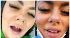 Prin ce chinuri a trecut o influenceriță de pe TikTok după ce și-a pus fațete dentare, de 42.000 de dolari