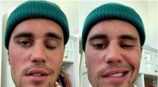 Justin Bieber, cu jumătate de față paralizată din cauza unei boli grave: “Vă rog, rugați-vă pentru mine”