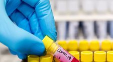 Studiu: coronavirusul nu suferă mutații rapide, așa că vaccinul ne-ar putea proteja ani de zile