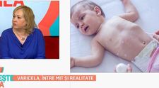 Varicela, boala copilăriei? Ce este mit și ce este adevărat