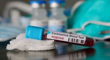 Coronavirus: De ce unii pacienții vindecați sunt testați, din nou, pozitiv