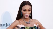 Winnie Harlow, apariție spectaculoasă pe Instagram. Cum a pozat celebrul modelul cu vitiligo