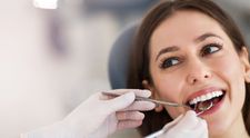 VIDEO Ce trebuie să știți despre fațetele dentare