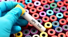 VIDEO Virusul HPV, periculos pentru femei și bărbați
