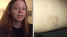 A petrecut seara într-un bar, iar a doua zi a descopeit că are o înțepătură de ac în picior. Ce i-au spus medicii