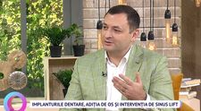 Dr. Ionuț Leahu, medic stomatolog, despre implanturile denare, adiția de os și intervenția de sinus lift