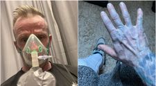 S-a trezit albastru din cap până în picioare și a fugit la spital. Când au descoperit cauza, medicii au început să râdă: 