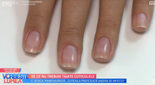 De ce nu trebuie tăiate cuticulele ne explică Dr. Cătălina Stoica