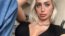 Ce s-a întâmplat cu un model OnlyFans care a urcat în avion, după ce a suferit o operație estetică