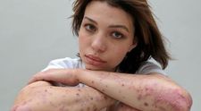 Oamenii si-au expus cicatricele intr-un proiect foto impresionant. Sunt genul de imagini care nu pot trece neobservate