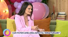 Cum putem ameliora aspectul vergeturilor. Sfaturi de la medicul specialist