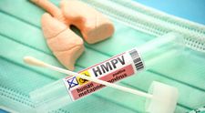 Rafila: „Zeci de mii de cazuri de metapneumovirus neconfirmate în România”. Recomandările INSP pentru prevenirea îmbolnăvirilor cu HMPV