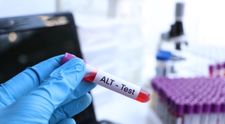 (P) Determinarea alaninaminotransferazei: când și de ce este indicată