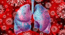Legătura între vitamina D și infectarea cu COVID-19. Ce se arată într-un studiu recent realizat de un medic român din Anglia