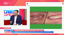 VIDEO Dr. Ionuț Leahu, despre implanturile dentare