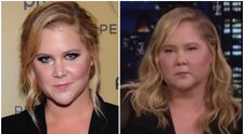 Amy Schumer și-a îngrijorat fanii. Ce explicație a dat pentru fața ”umflată și buhăită” din ultima apariție la TV
