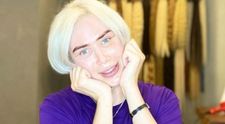 Un tânăr de 31 de ani a trecut prin 18 operații estetice, dorindu-și o asemănare cu idolul său