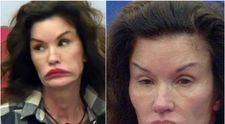 Primul supermodel al lumii a ajuns de nerecunoscut!  În tinerețe avea un chip perfect și corp de zeiță, dar operațiile estetice au mutilat-o! Prima intervenția și-a făcut-o când era iubita lui Sylvester Stallone