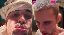 Justin Bieber, într-o stare alarmantă: Hailey Bieber cere disperată ajutor pentru soțul ei! 