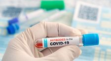Cât de relevante sunt testele de anticorpi pentru cei vaccinați și pentru cei care au trecut prin COVID-19?