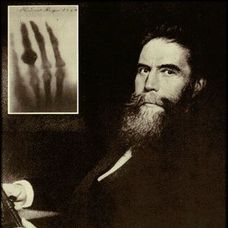 Wilhelm Rontgen