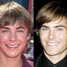 Zac Efron