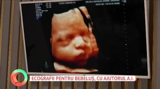 Ecografii pentru bebeluș, cu ajutorul A.I.