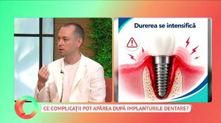 Ce complicații pot apărea după implanturile dentare?