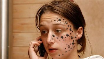 Si-a tatuat o intreaga constelatie pe fata. Cum arata dupa 3 ani de tratamente dureroase, ca sa le indeparteze