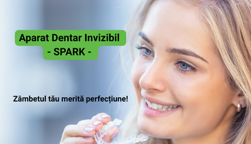 (P) Aparatul dentar invizibil – zâmbește în stilul tău, fără compromisuri