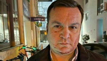 De ce apare Cătălin Cherecheș cu răni pe față. Ce a vrut să facă edilul înainte de a fi prins de polițiștii germani