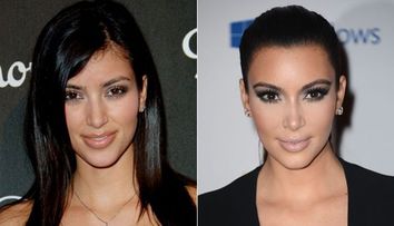 Chipul perfect al lui Kim Kardashian, rezultatul operatiilor estetice de mii de dolari. Imaginile de care spera sa nu-si mai aminteasca nimeni