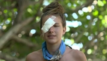 De ce a apărut Alexandra Ciomag cu ochiul bandajat la Survivor All Stars. Fanii, de-a dreptul îngrijorați pentru Războinică
