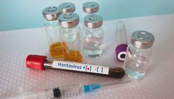 Ce simptome provoacă hantavirus, virusul potențial mortal care s-a răspândit acum pe o croazieră în Atlantic și care a ucis-o pe soția lui Gene Hackman