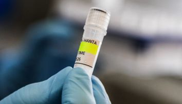 Posibil caz de hantavirus în Spania! O femeie a fost izolată în Alicante, după ce a avut contact cu un pacient infectat