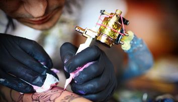 Cum arata pielea dupa eliminarea unui tatuaj cu ajutorul laserului. Imaginile sunt virale