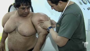 Cazul uluitor al barbatului care facea scufundari si s-a umflat tot cand a iesit din apa!
