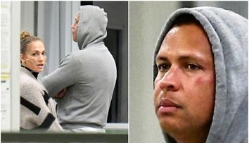 Alex Rodriguez, cu ochiul vânăt la câteva zile după ce a fost acuzat de infidelitate. J Lo, ce i-ai făcut?