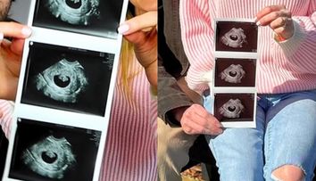 Influencerița și soțul ei au decis să întrerupă sarcina după ce au aflat că fătul are sindromul Down. Sunt amenințați cu moartea și dorm cu un pistol lângă pat: „Nu mi-am dat seama cât de greu este pentru copil”