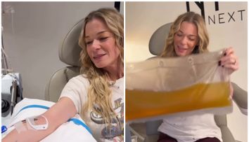 LeAnn Rimes, tratament extrem de „curățare a sângelui” de 45.000 de dolari, după ce i-au căzut dinții pe scenă